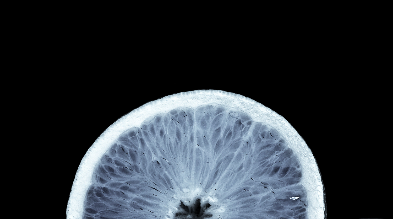 Xray Header V2 BRIGHT TALL